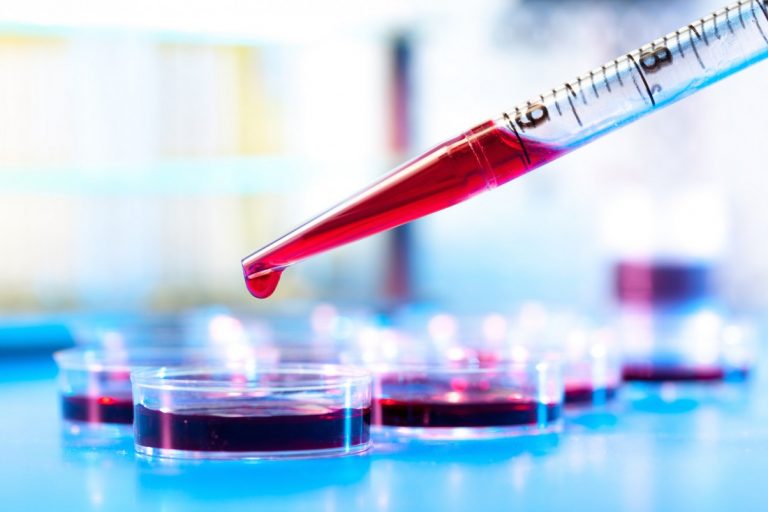Here’s What The Latest Global Blood Therapeutics, Inc. (NASDAQ:GBT) News Means For Shareholders